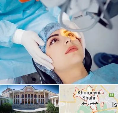 دکتر عمل لیزیک چشم در خمینی شهر