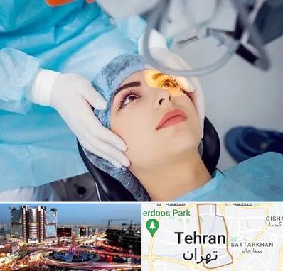دکتر عمل لیزیک چشم در صادقیه تهران