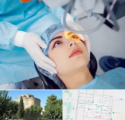 دکتر عمل لیزیک چشم در مرداویج اصفهان