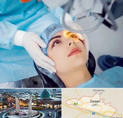 دکتر عمل لیزیک چشم در زنجان