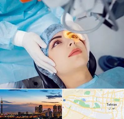 دکتر عمل لیزیک چشم در غرب تهران