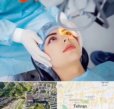 دکتر عمل لیزیک چشم در شمال تهران