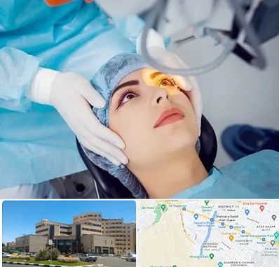 دکتر عمل لیزیک چشم در صیاد شیرازی مشهد