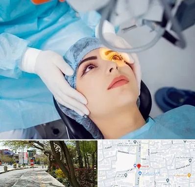 دکتر عمل لیزیک چشم در خیابان توحید اصفهان