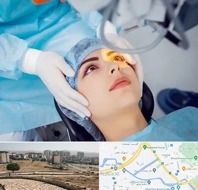 دکتر عمل لیزیک چشم در کوی وحدت شیراز