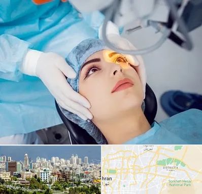 دکتر عمل لیزیک چشم در شرق تهران