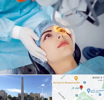 دکتر عمل لیزیک چشم در فلکه گاز شیراز
