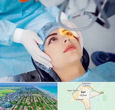 دکتر عمل لیزیک چشم در ساری