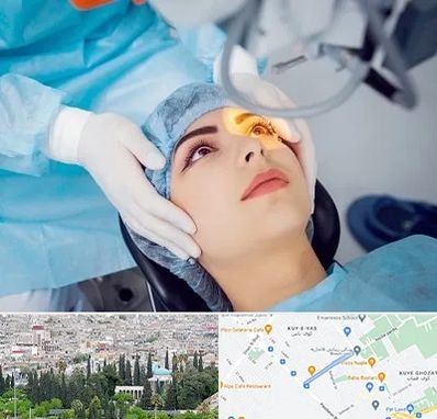 دکتر عمل لیزیک چشم در محلاتی شیراز