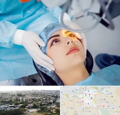 دکتر عمل لیزیک چشم در منطقه 20 تهران