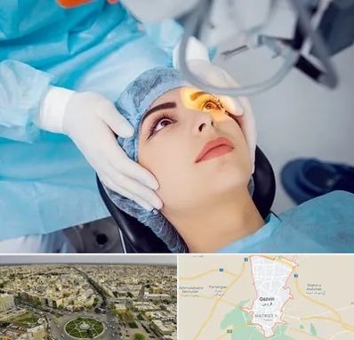 دکتر عمل لیزیک چشم در قزوین