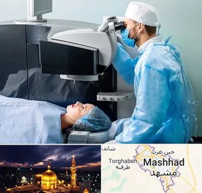 مرکز لیزیک چشم در مشهد