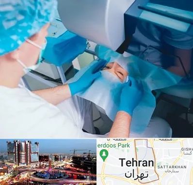 دکتر عمل لازک چشم در صادقیه تهران
