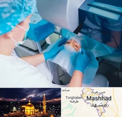 دکتر عمل لازک چشم در مشهد