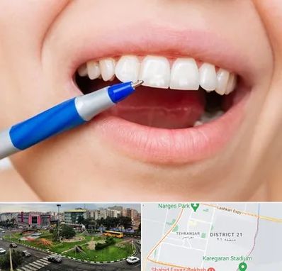 دندانسازی ارزان در تهرانسر 