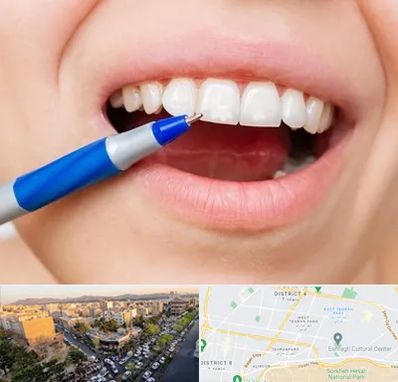 دندانسازی ارزان در تهرانپارس 