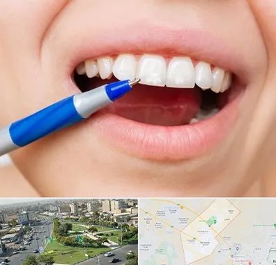 دندانسازی ارزان در کمال شهر کرج 