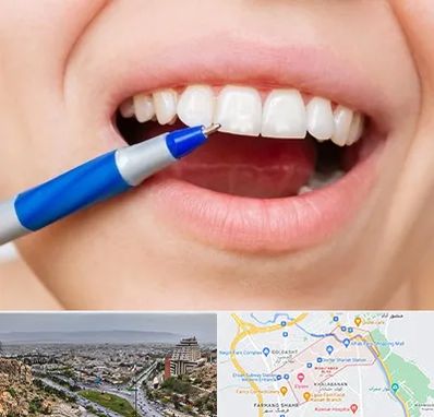 دندانسازی ارزان در معالی آباد شیراز 