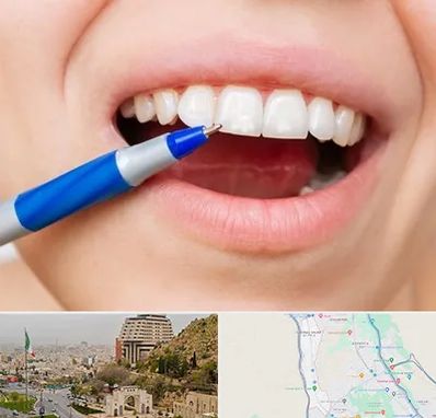 دندانسازی ارزان در فرهنگ شهر شیراز 