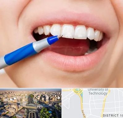 دندانسازی ارزان در استاد معین 