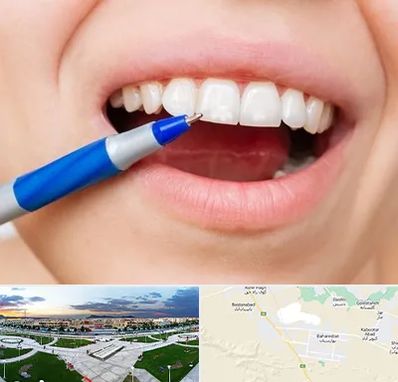 دندانسازی ارزان در بهارستان اصفهان 
