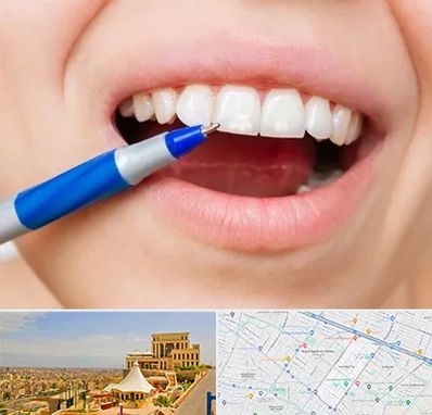 دندانسازی ارزان در هاشمیه مشهد 