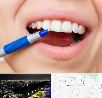 دندانسازی ارزان در هفت تیر مشهد 