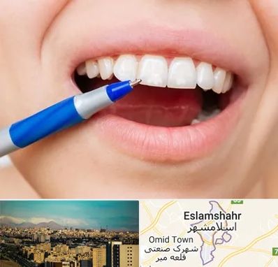 دندانسازی ارزان در اسلامشهر