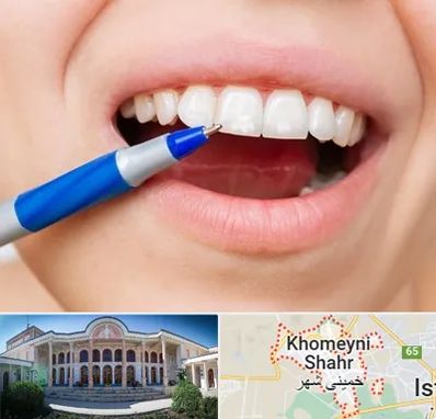 دندانسازی ارزان در خمینی شهر
