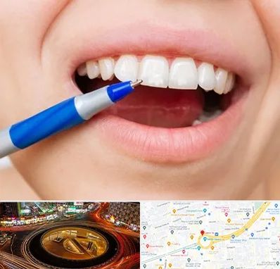 دندانسازی ارزان در میدان ولیعصر 