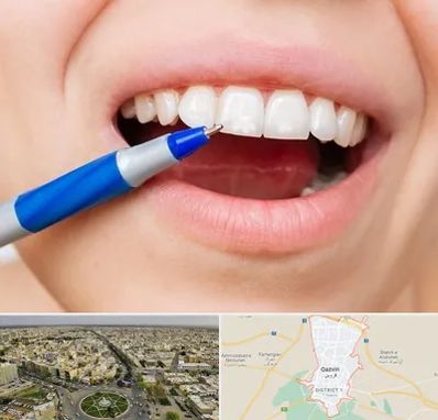 دندانسازی ارزان در قزوین