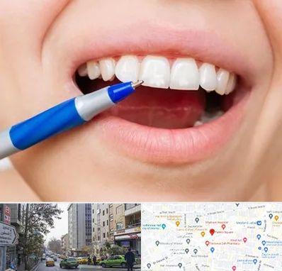 دندانسازی ارزان در فاطمی 