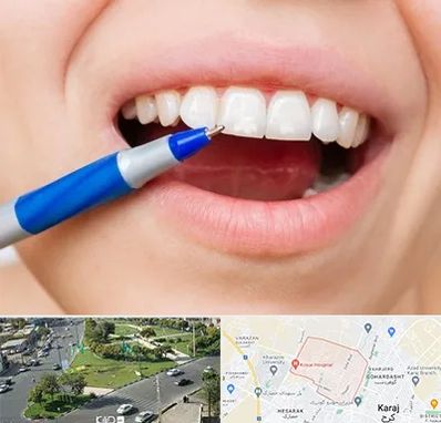 دندانسازی ارزان در شاهین ویلا کرج 
