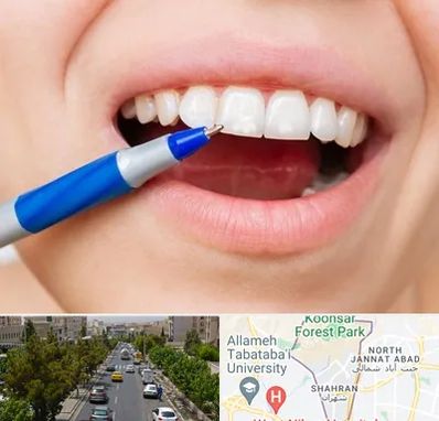 دندانسازی ارزان در شهران 