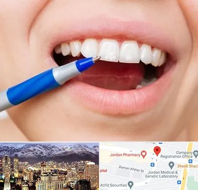 دندانسازی ارزان در جردن 