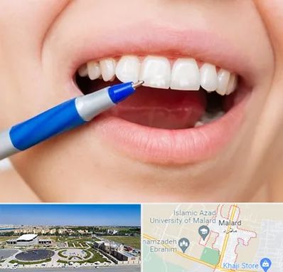 دندانسازی ارزان در ملارد