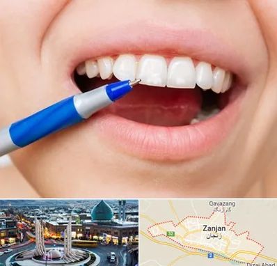دندانسازی ارزان در زنجان