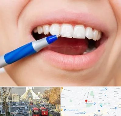 دندانسازی ارزان در خیابان آزادی 