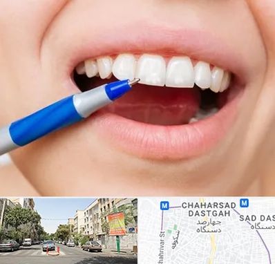 دندانسازی ارزان در چهارصد دستگاه 