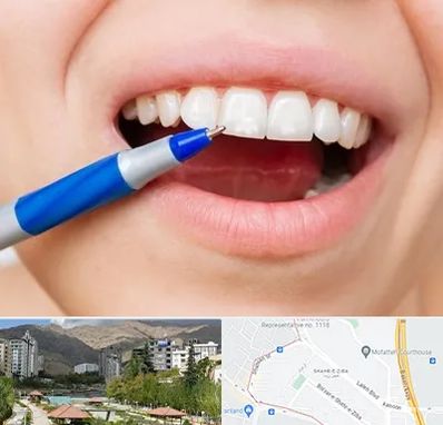 دندانسازی ارزان در شهر زیبا 