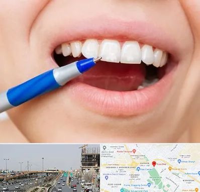 دندانسازی ارزان در بلوار توس مشهد 