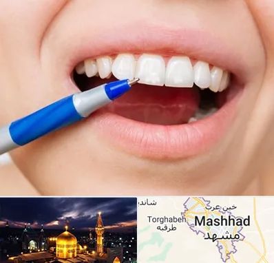 دندانسازی ارزان در مشهد