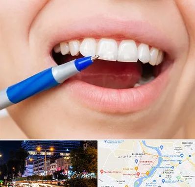 دندانسازی ارزان در کیانپارس اهواز 