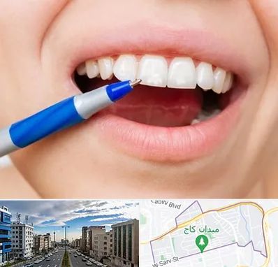 دندانسازی ارزان در سعادت آباد 