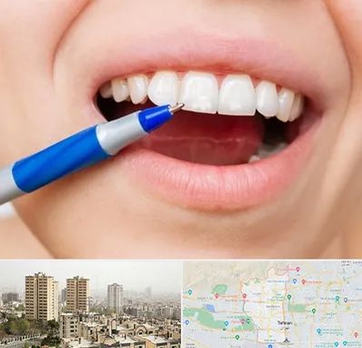 دندانسازی ارزان در منطقه 5 تهران 