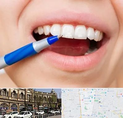 دندانسازی ارزان در منطقه 11 تهران 