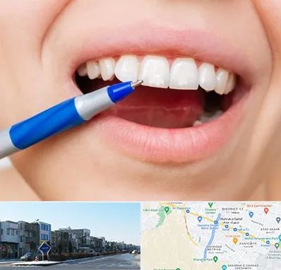 دندانسازی ارزان در شریعتی مشهد 
