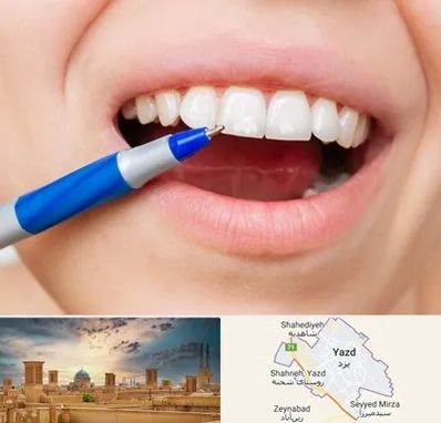 دندانسازی ارزان در یزد