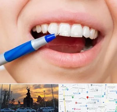 دندانسازی ارزان در میدان حر 
