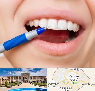 دندانسازی ارزان در کرمان